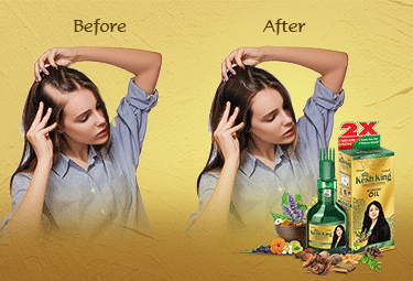 Know Which Is the Best Ayurvedic Hair Oil for Hair Fall Treatment?