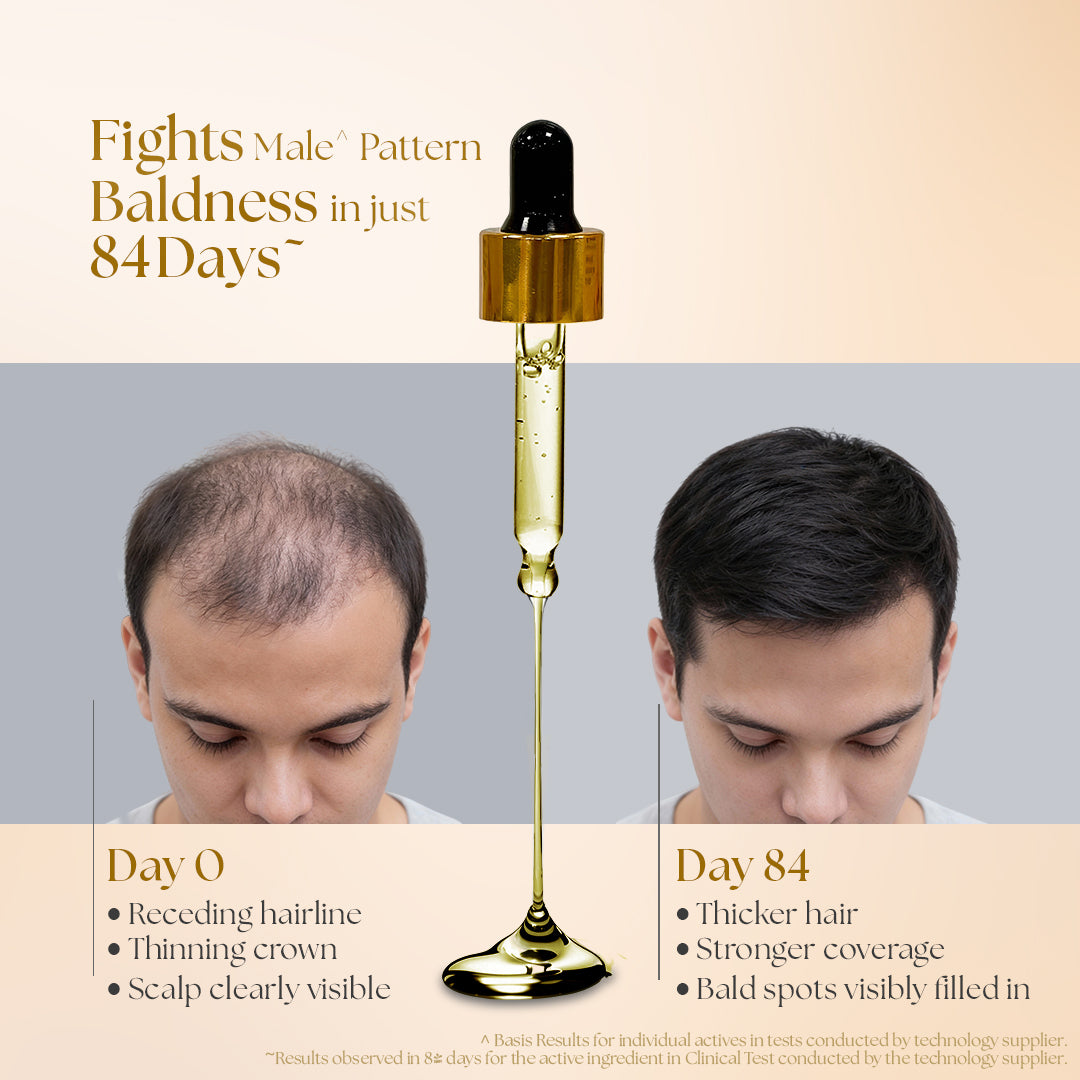 Kesh King Gold Advanced Hair Growth Serum 30 ml