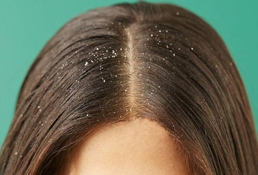 Give Your Hair Some Extra Nourishment with Kesh King Products