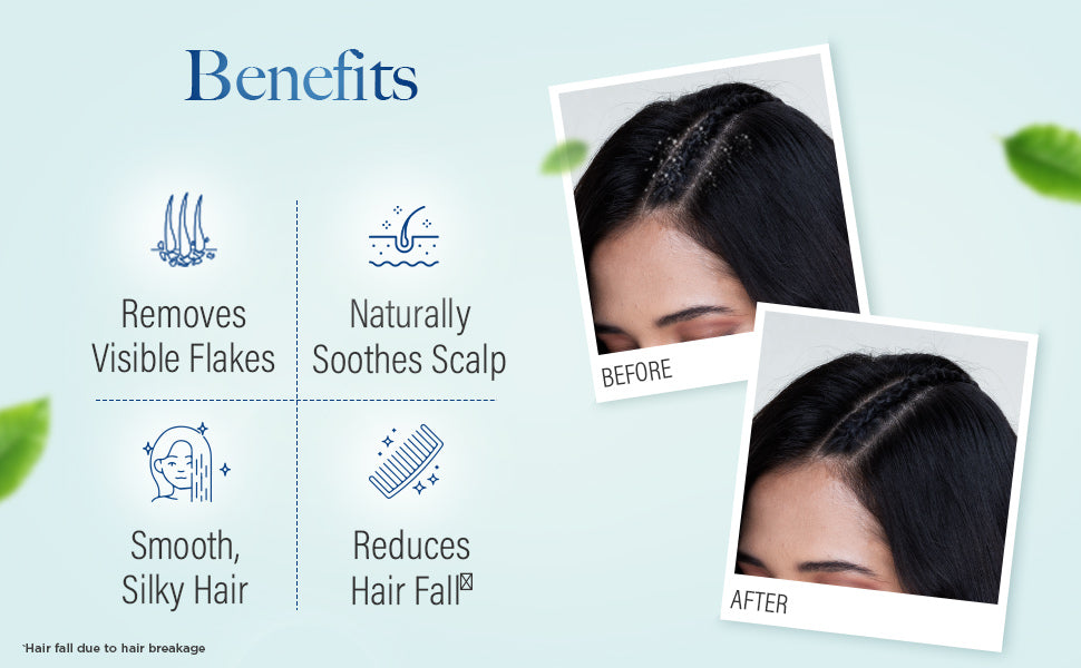 Kesh King Gold Anti-Dandruff Shampoo results
