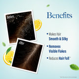 Kesh King Gold Anti-Dandruff Shampoo