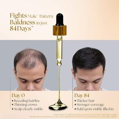 Kesh King Gold Advanced Hair Growth Serum 30 ml