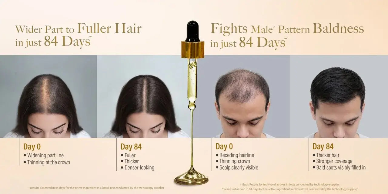 Kesh King Gold Advanced Hair Growth Serum results